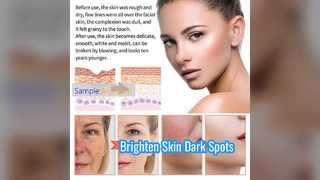 Brighten Skin Dark Spots Vitamin C Serum