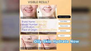 Hydrating Hyaluronic Toner for Oily Skin