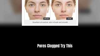 Clear Pores Blackheads Acne Mud Mask